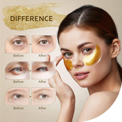 24K Gold Collagen Eye Patches - Puffy Bags, Dark Circles & Wrinkle Reduction (30 Pairs)