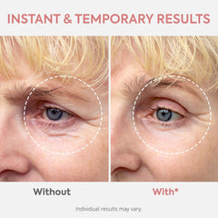 Instant Eye & Face Lift: Rapid Under Eye Bags, Wrinkles, Smile & Forehead Lines Remover, 2-Minute Treatment in 1 fl. oz