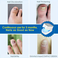 LED Display White Nail Lamp for Toe Nail Treatment