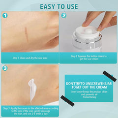 Advanced Silicone Scar Cream & Gel - Professional Treatment for Surgical, Stretch, Old & New Scars, 1.7 oz