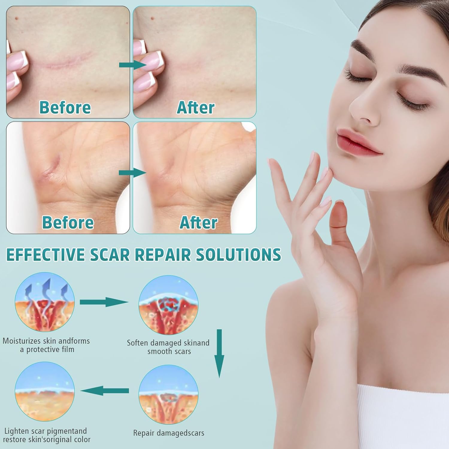 Advanced Silicone Scar Cream & Gel - Professional Treatment for Surgical, Stretch, Old & New Scars, 1.7 oz