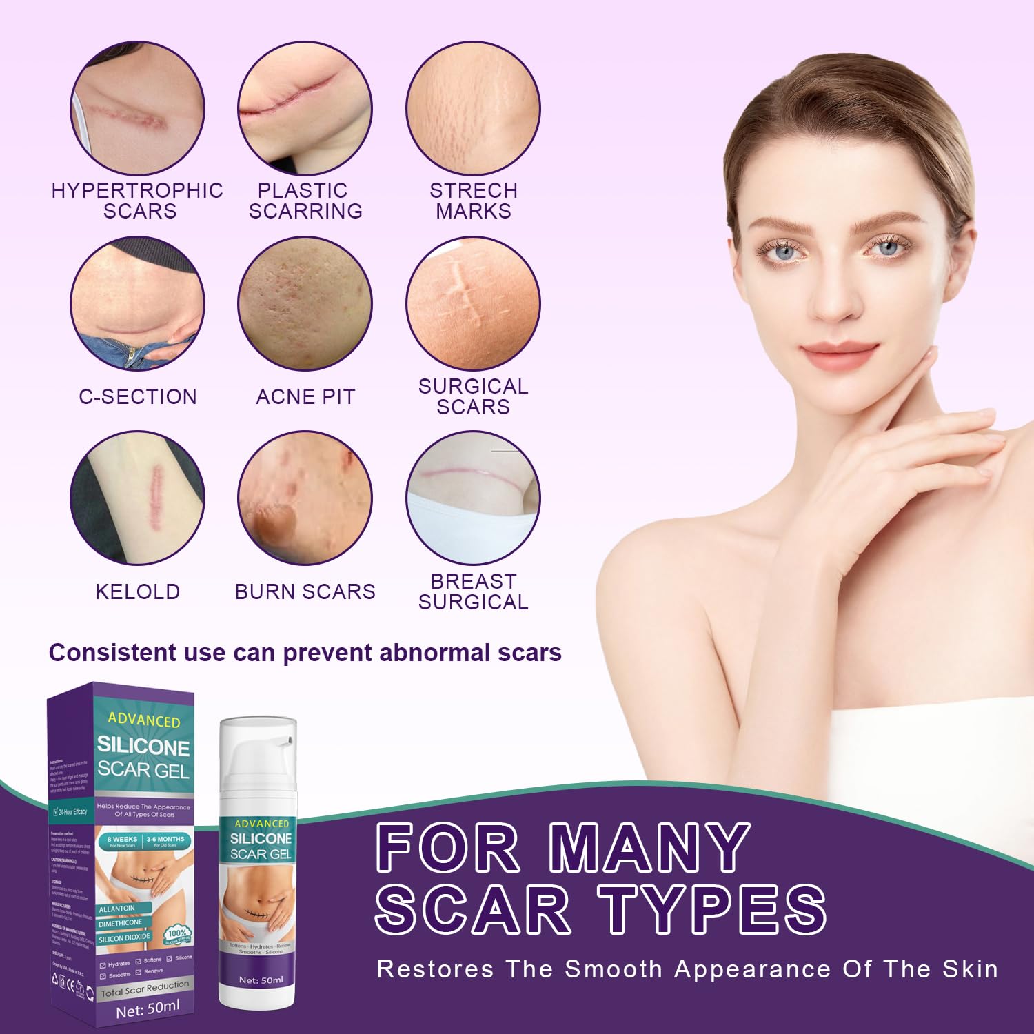 Silicone Scar Cream & Gel - Advanced Treatment for Stretch Marks, Scars, Burns, Acne, C-Section, Keloid - Unisex, 1.76Oz