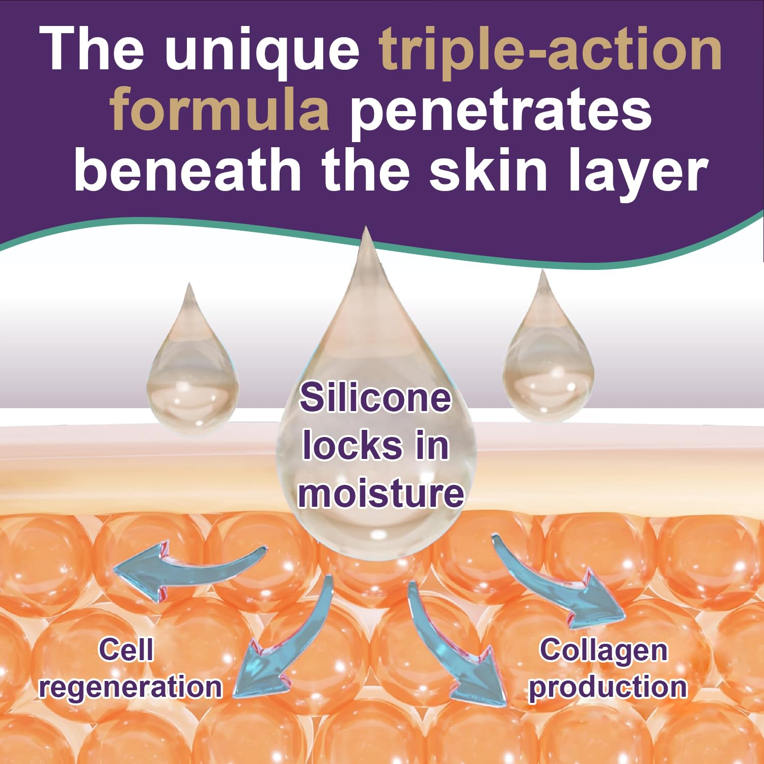 Silicone Scar Cream & Gel - Advanced Treatment for Stretch Marks, Scars, Burns, Acne, C-Section, Keloid - Unisex, 1.76Oz